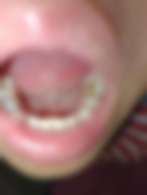 太仓市第二人民医院:口腔科常见疾病治疗优选