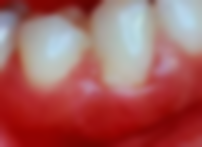 牙痛肿胀时的替代治疗方案