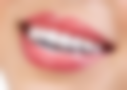 烤瓷牙吃瓜子可能面临的风险