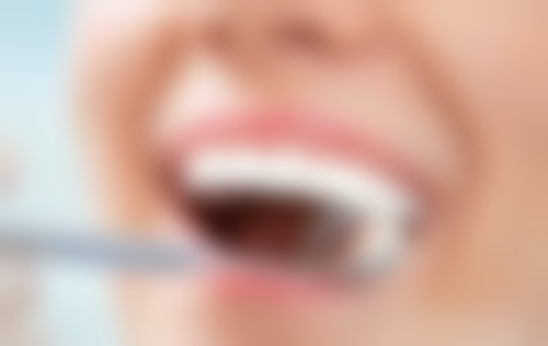 拔牙后发炎吃什么消炎？阿莫西林、头孢、甲硝唑等药物或为有效之选