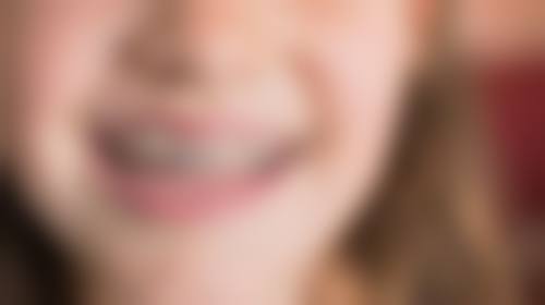 第二次根管治疗费用分析