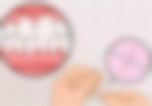 如何正确看待牙齿做根管治疗