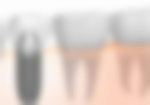 河南鹤壁崇德口腔真人口碑评价怎么样？