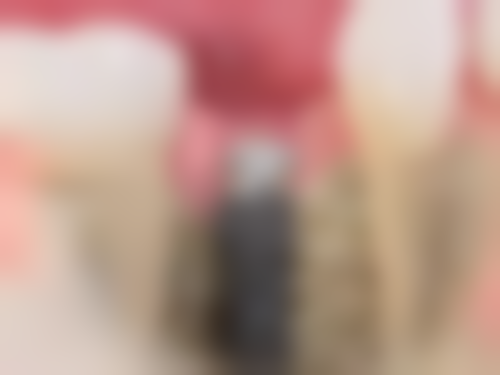 洛阳拜博口腔医院真人口碑评价怎么样?