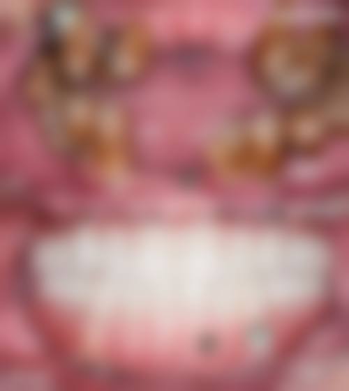 深圳格伦菲尔口腔相关项目价格