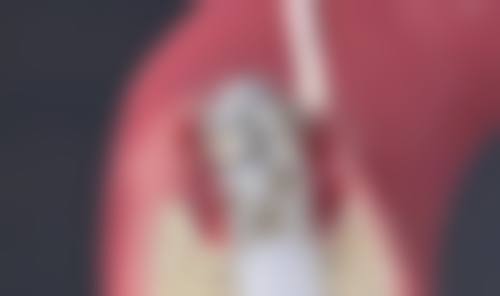 常熟明日口腔医院种植牙怎么样？正规靠谱且收费实惠，如韩国DIO种植牙4980元起/颗！ 