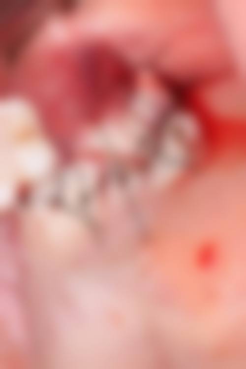 五、综合评价反馈：患者好评如潮，口腔诊疗好选择