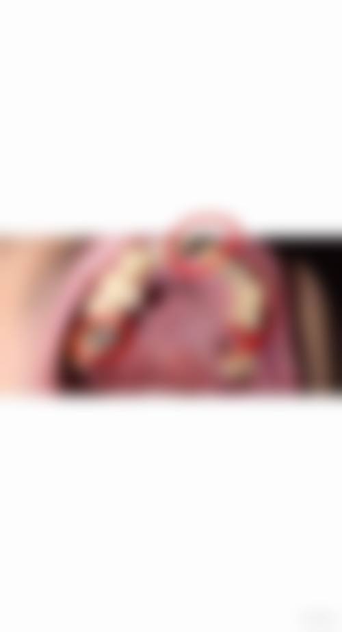 四、滨州益洁口腔门诊部:多样正畸,补牙镶牙全搞定