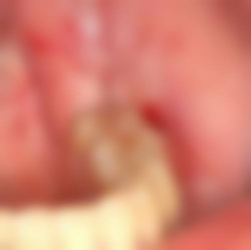 西安达芬琪口腔医院怎么样正规吗？正规！连锁3院技术强，正畸12000起，种植4580起 