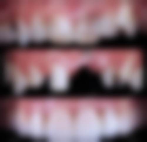 合肥壹加壹口腔特色项目及技术优势