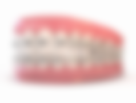 纯钛牙和全瓷牙的耐用性对比