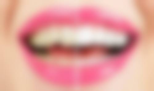 麻涌乐雅口腔门诊部是正规医院吗?