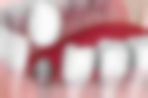 湖北宜昌皓康口腔特色项目及技术优势