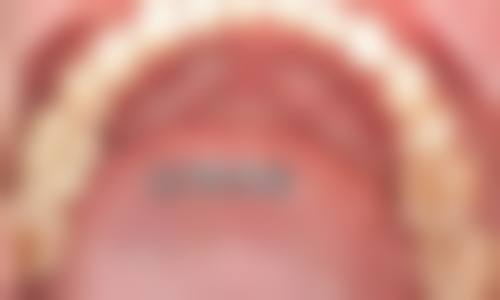 南京江宁永华口腔诊所特色项目及技术优势