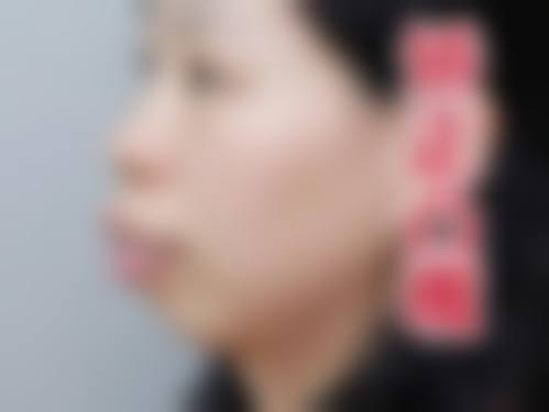 聂庆森医生擅长项目