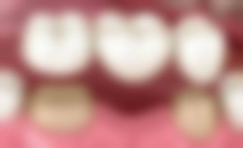 平顶山佳美口腔门诊部详细的预约挂号方式及流程