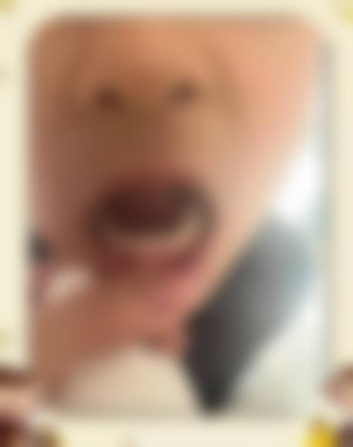 深圳博菲特口腔门诊部详细的预约挂号方式及流程