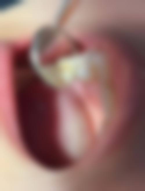 长沙开福红杉树口腔门诊部特色项目及技术优势