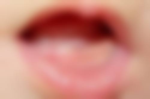 上海悦牙口腔许曼怎么样？技术过硬经验丰富，精准诊断嘴凸问题还设计专属方案，服务贴心超靠谱！ 