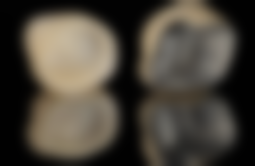 如何选择适合自己的宁波口腔医院