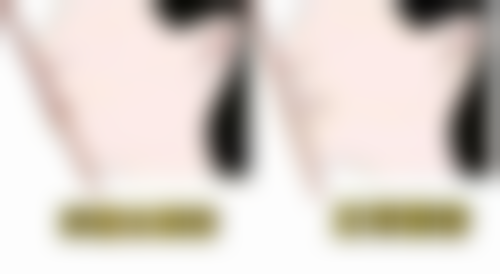 刘学敏医生技术特色:精良设备,推测技术前列