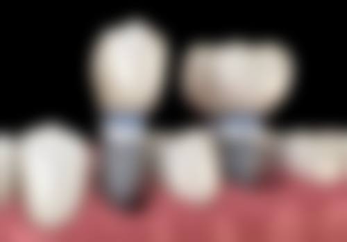 新疆库尔勒江南口腔医院真人口碑评价怎么样？