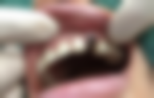 东莞虎门丽阳口腔门诊部是正规医院吗？