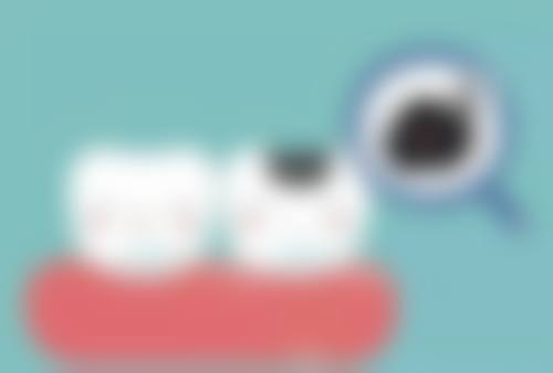 二、乌鲁木齐天牙口腔——数字化矫正，儿童补虫牙低价之选