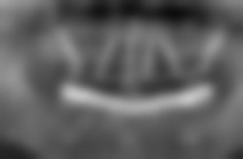 {铜陵半口种植医院24小时在线咨询：渡江口腔省40%、柏年省36%，多院优势任你选！ 