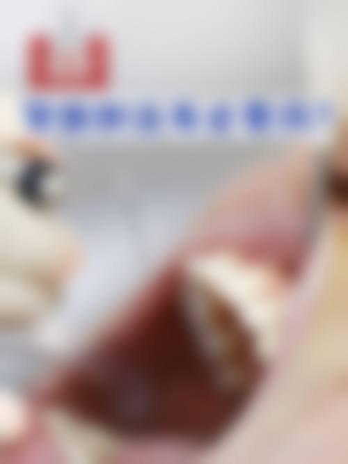 走近张草医生，了解儿童齿科骨干医生风采