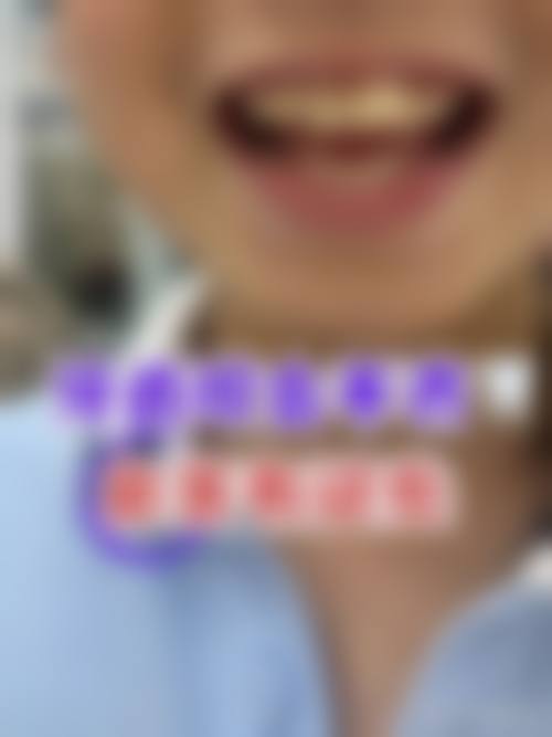 王辉医生口碑评价及真人实例