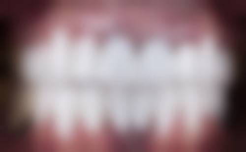 雅致口腔医院：高性价比拔牙的热门之选