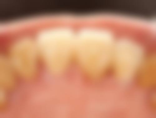 叶丽萍医生执医荣誉