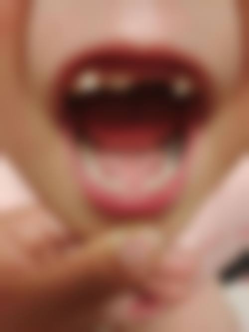 三、乌鲁木齐福宏林口腔——连锁优势，疑难矫正骨干医生之选