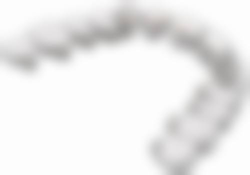 舌侧矫正大揭秘，优势特点全知晓