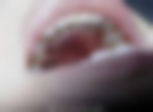 柏乐口腔优势多，矫正成效有保护