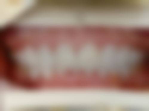 广东广州李雄口腔门诊部详细的预约挂号方式及流程