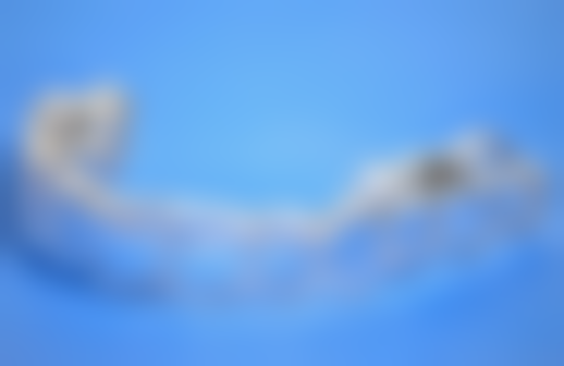 治疗流程与时间