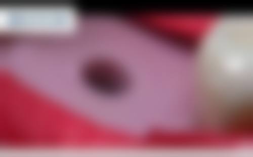 种植牙多少钱2026 ？单颗集采价格680 - 15000 元不等，全口All - on - 6 即刻负重 12 万元起 