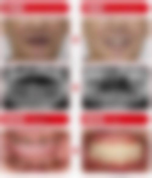 影响2026年种植牙价格的因素