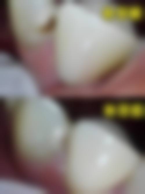 南安牙齿矫正24小时在线咨询：想矫正牙齿？这5家机构任你选！如艾丽美金属托槽矫正12800元起 