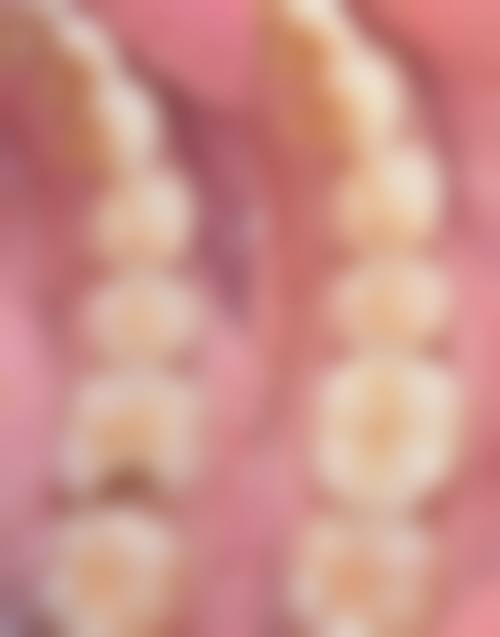 六、南安牙科牙齿矫正收费参考