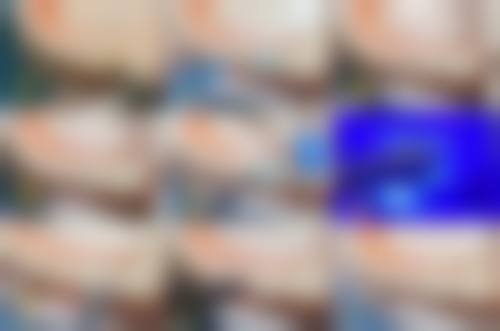 山东临沂兰山健齿佳口腔真人口碑评价怎么样?