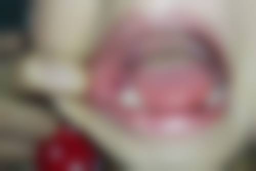 驻马店儿童牙科医生24小时在线咨询？市中心医院、啄木鸟门诊等技术强，预约挂号速来 