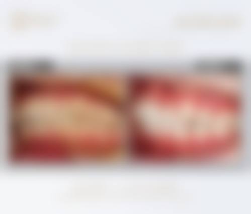 桂林隐形矫正医院24小时在线咨询！成人正雅15800元起，儿童隐适美first25000元起 