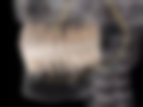 安徽阜阳阜南于胜龙口腔详细的预约挂号方式及流程