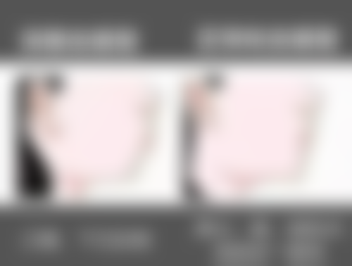 金合金烤瓷牙材料与其他烤瓷牙材料的对比