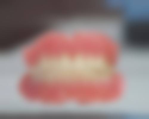 上海摩恩齿科价格表/收费标准