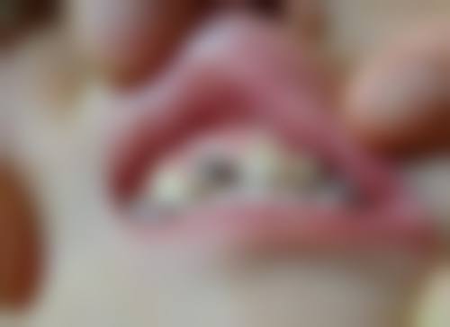 拉萨市人民医院口腔科：基础诊疗价格亲民