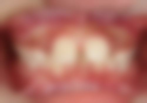 长春中妍整形医院真人实例